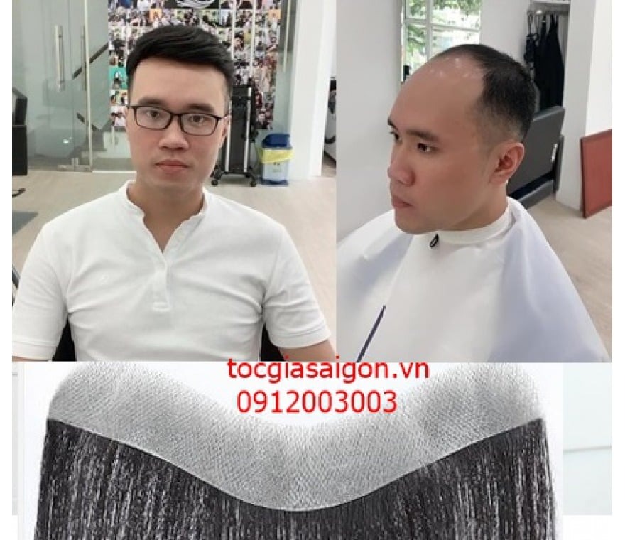 Top 5 Thương hiệu tóc giả cho nam giới uy tín nhất tại Việt Nam  Toplistvn