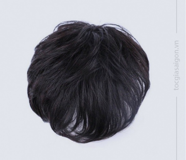 Rụng tóc, hói đầu đang là vấn đề mà nhiều đàn ông Việt Nam gặp phải