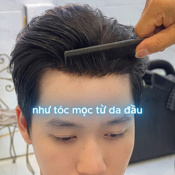 Cận cảnh kết cấu lưới mỏng tệp da đầu của tóc giả nam phủ hói da siêu lưới làm từ 100% tóc thật tại Tóc Giả Sài Gòn